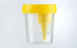 Negative pressure urine cup - 60ml